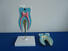 Tooth Model Pharmaceutical and Anatomical Model Gifts